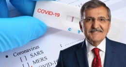 Beykoz Belediye Başkanı Murat Aydın koronavirüse yakalandı!..